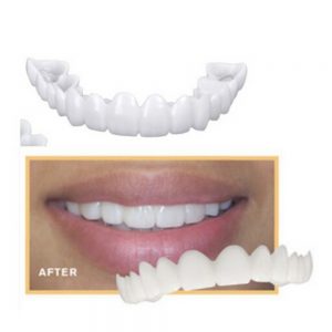 Instant perfect smile veneers