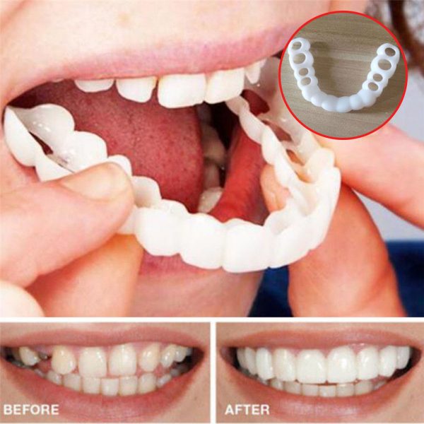 Beautiful Teeth Cover, Denture Instant perfect smile veneers, Comfort Fit Flex fake tooth cover