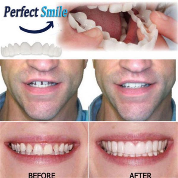 Beautiful Teeth Cover, Denture Instant perfect smile veneers, Comfort Fit Flex fake tooth cover