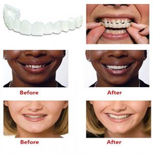 Beautiful Teeth Cover, Denture Instant perfect smile veneers, Comfort Fit Flex fake tooth cover