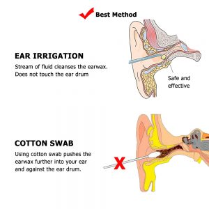 Adults Kid Ear Irrigation Cleaning Kit Premium Ear Wax Removal Kit with Ear Washing Syringe Squeeze Bulb Ear Health Care