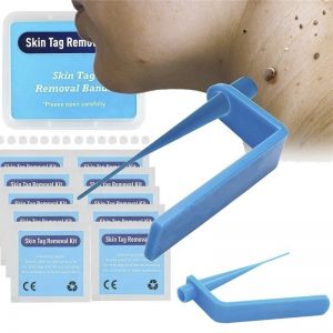 Mrico Skin Tags Warts Remover Kit Remove Warts Skin Tag Body Skin Treatment Face Skin Tag Removal Acne Remover